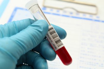 NUTRIADAPT Test na Leidenskou mutaci: ano, či ne? KREV